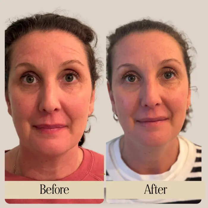 Free Sample of Holy Elixir no. 1 Serum